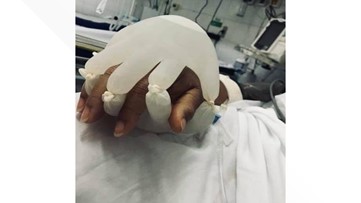 Photo of gloves 'holding' hand of COVID patient a heartbreaking reminder of pandemic's continued devastation