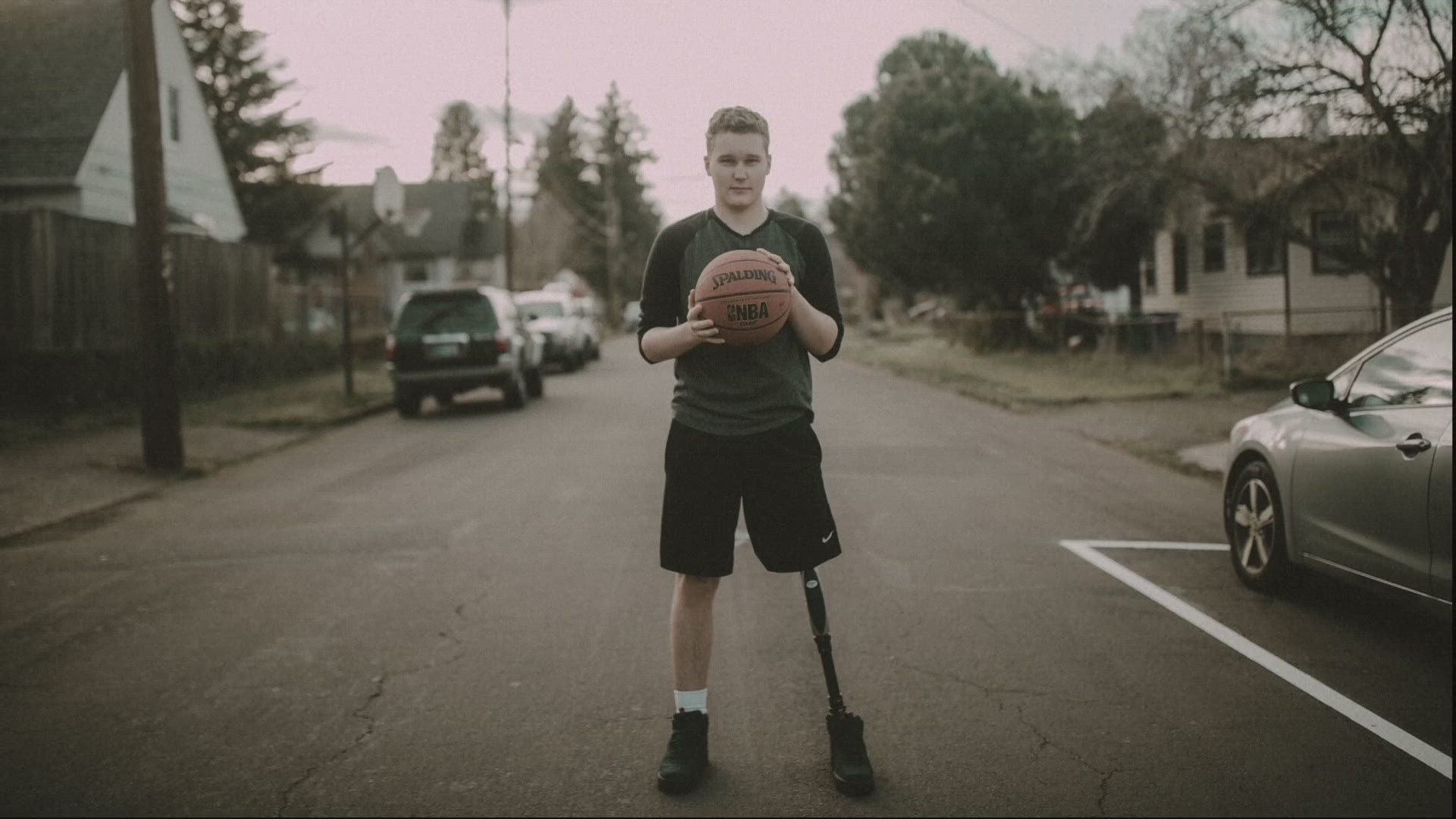 Atticus Root, who has battled bone cancer since he was 13, said his custom-made prosthetic leg was stolen from his car's trunk.