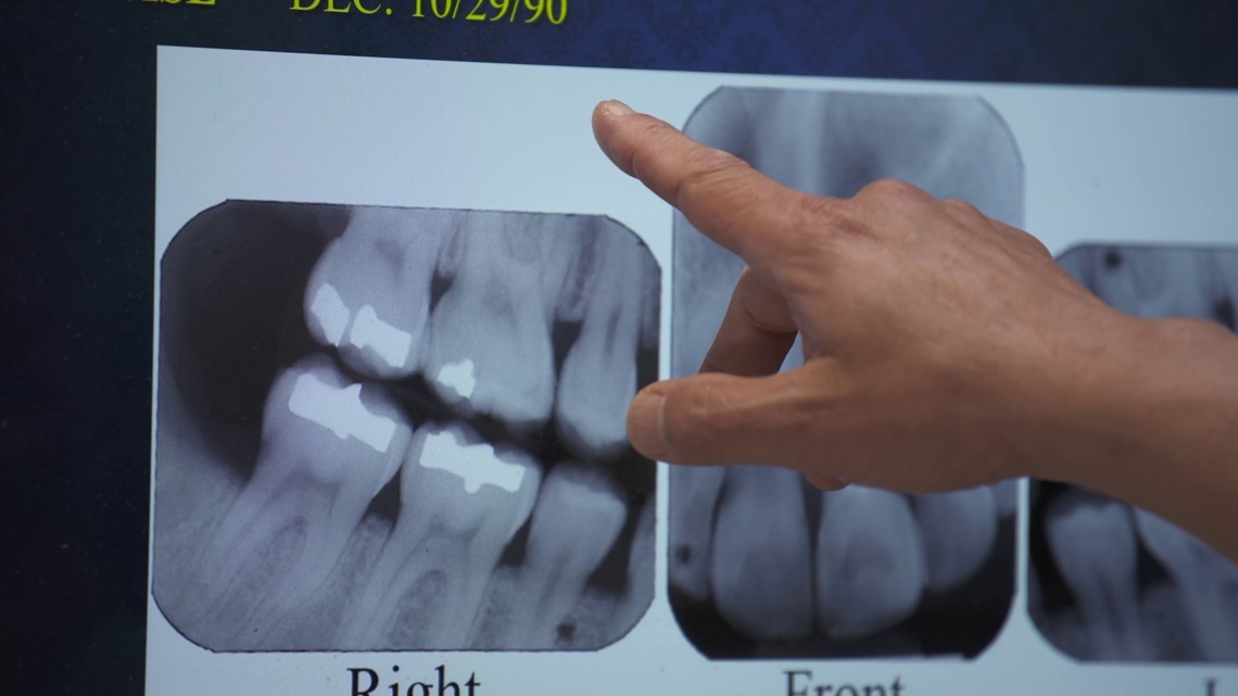 An inside look at WSP's forensic dental records system - Vimarsana News