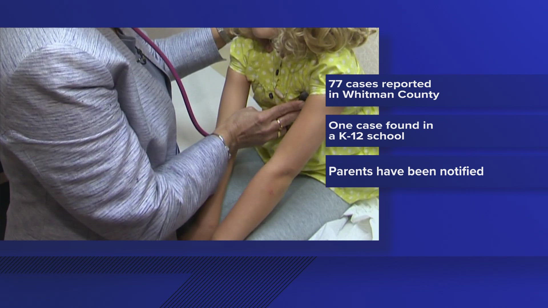 Whooping cough continues to spread in Whitman County, according to a new report released on Friday.