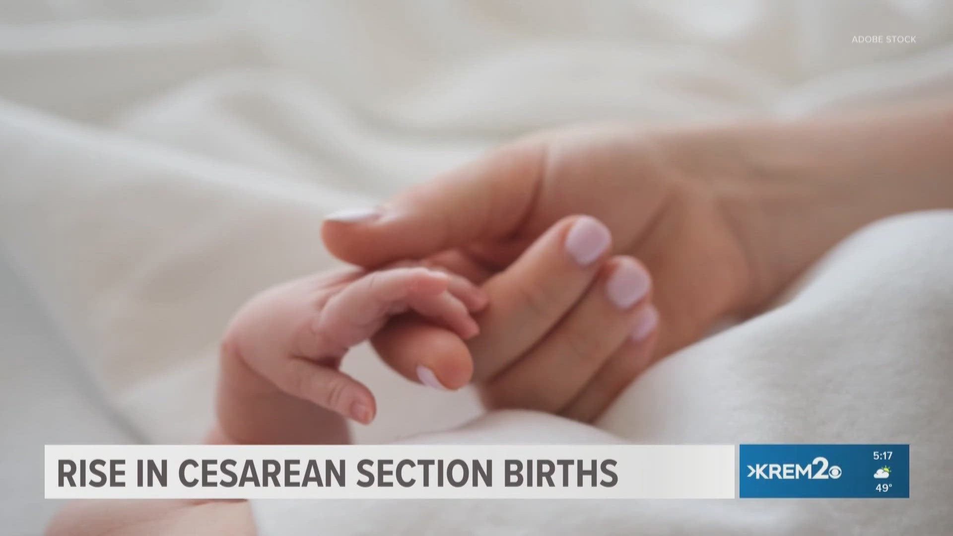 The latest data from the CDC shows C-sections are going up. (Video via CBS News)