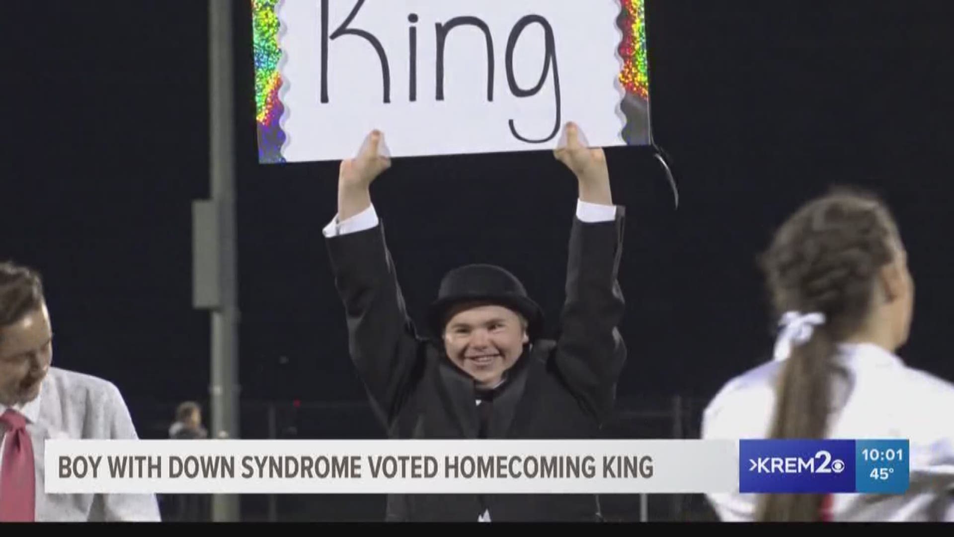 Boy with down syndrome elected homecoming king