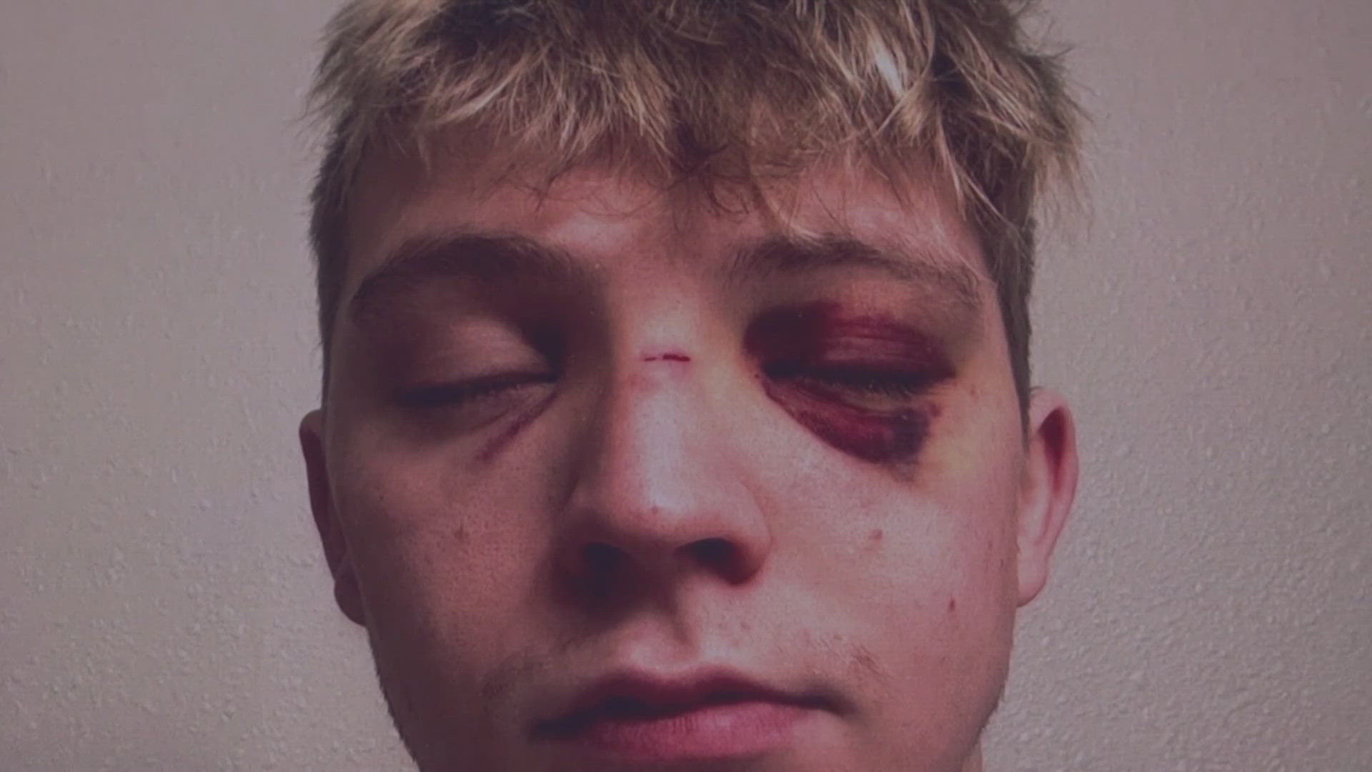 Moscow Police told KREM 2 they won't be pressing charges after an off-campus fight in February