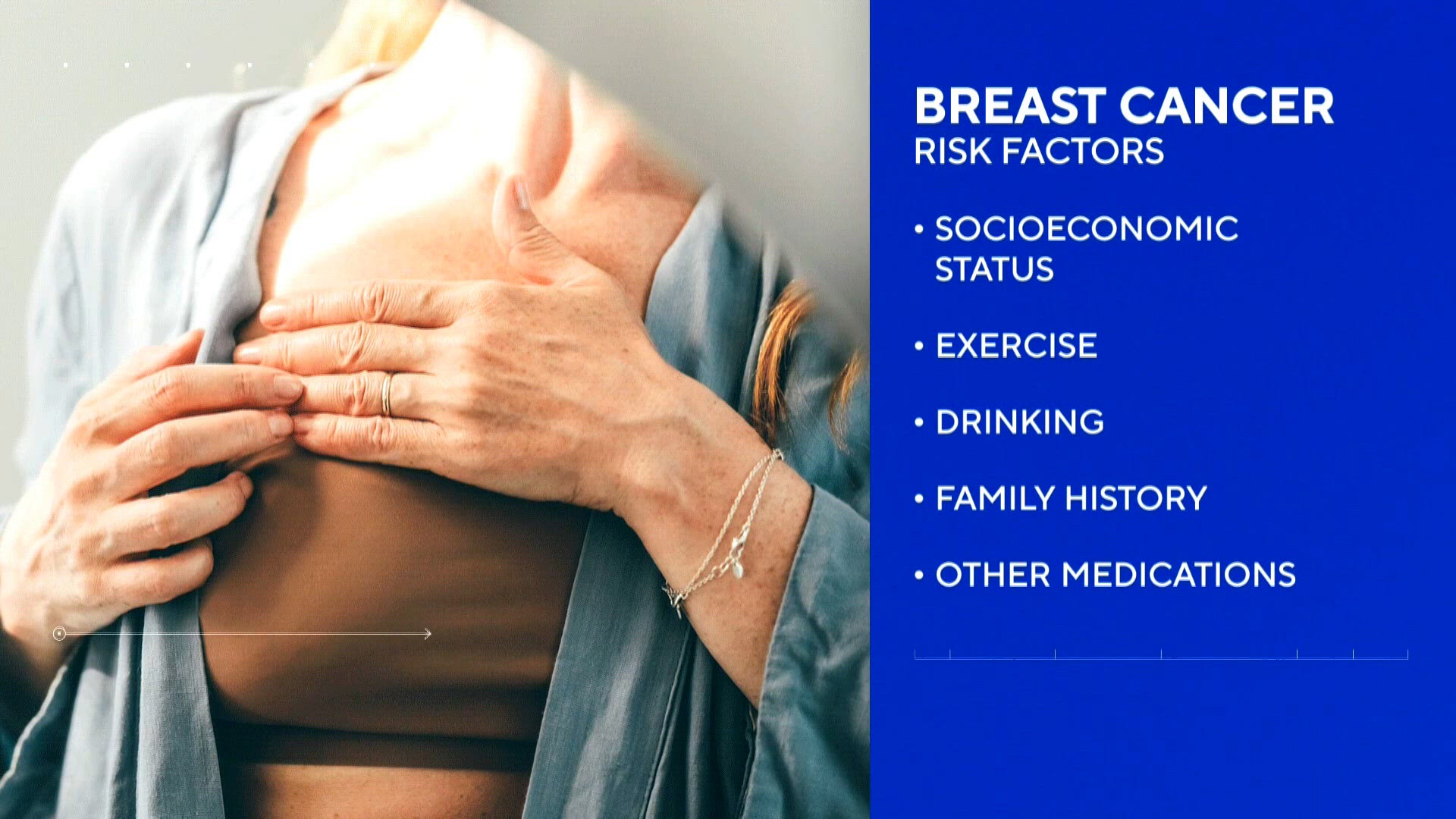 GLP 1 users less likely to develop breast cancer
