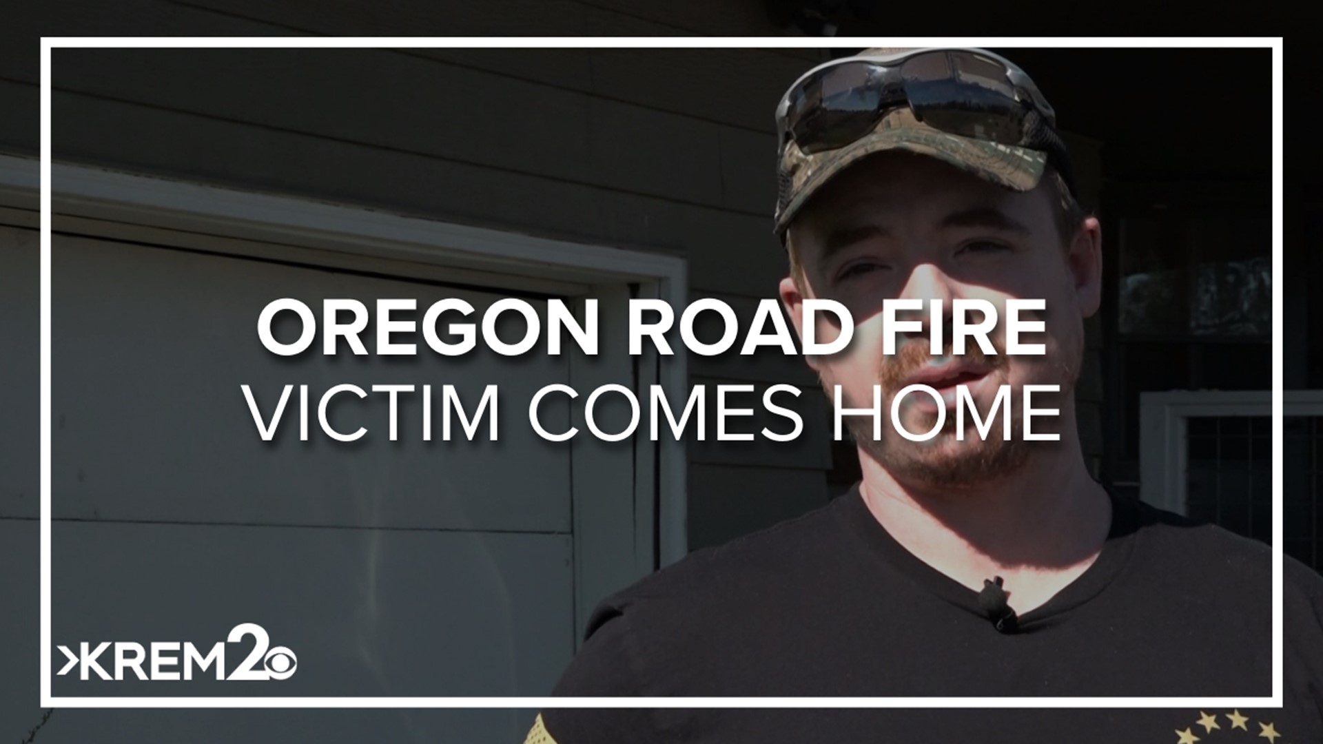 With second-degree burns on 30% of his body, Justin is now home and trying to rebuild.