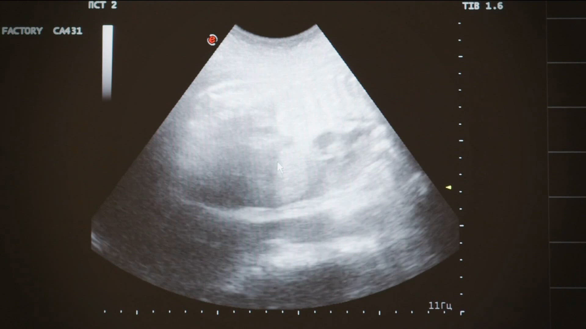 Idaho doctors debate how Proposition 1 could affect abortion and ...