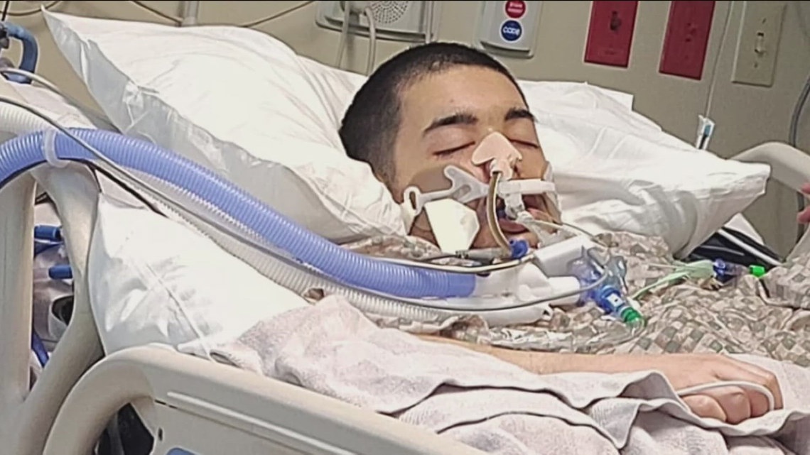 Pocatello teen in critical condition after police shooting | krem.com