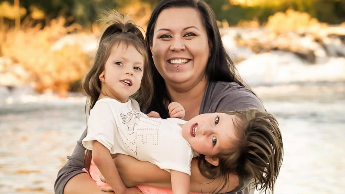 7 s HERO Idaho Conjoined Twins Callie And Carter Are Beating The Odds 