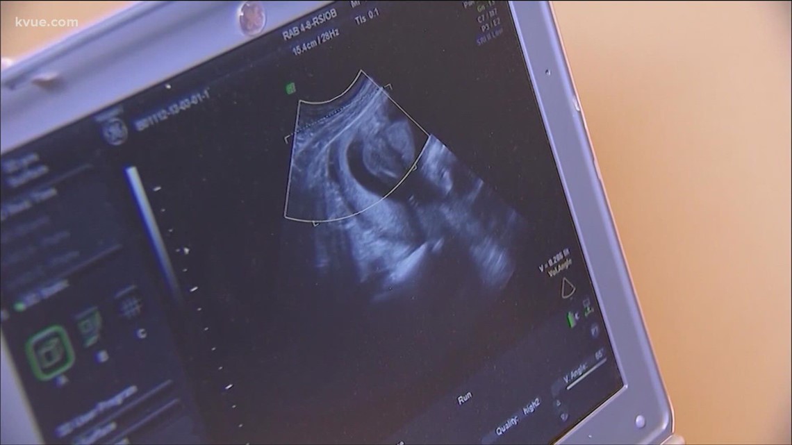Reactions mixed from North Idaho nonprofits after abortion law - Vimarsana News