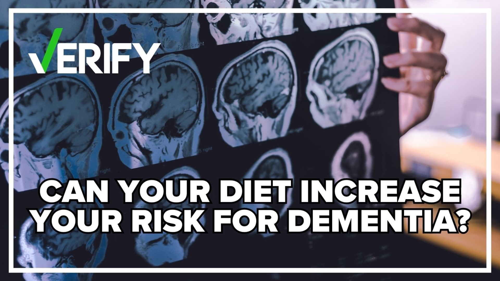 More than 6 million Americans age 65 and older suffer from Alzheimer's. Could your diet play a role in developing dementia?