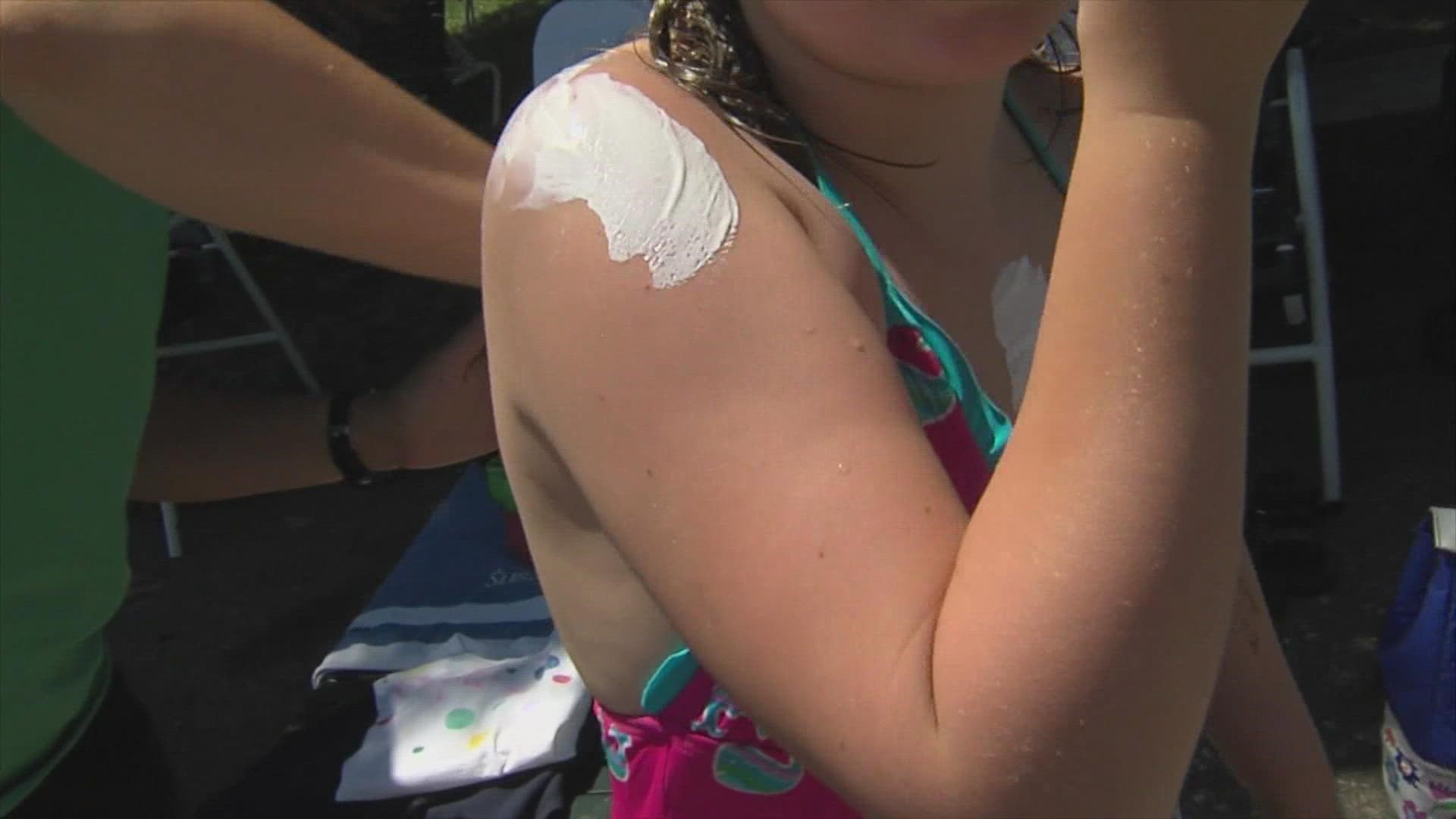 Kids might not always take the proper precautions in the sun.