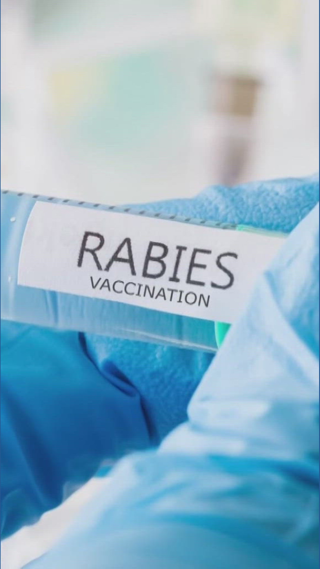Michigan man who died from rabies traced to infected kidney from Idaho ...